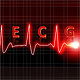 ECG Quartet